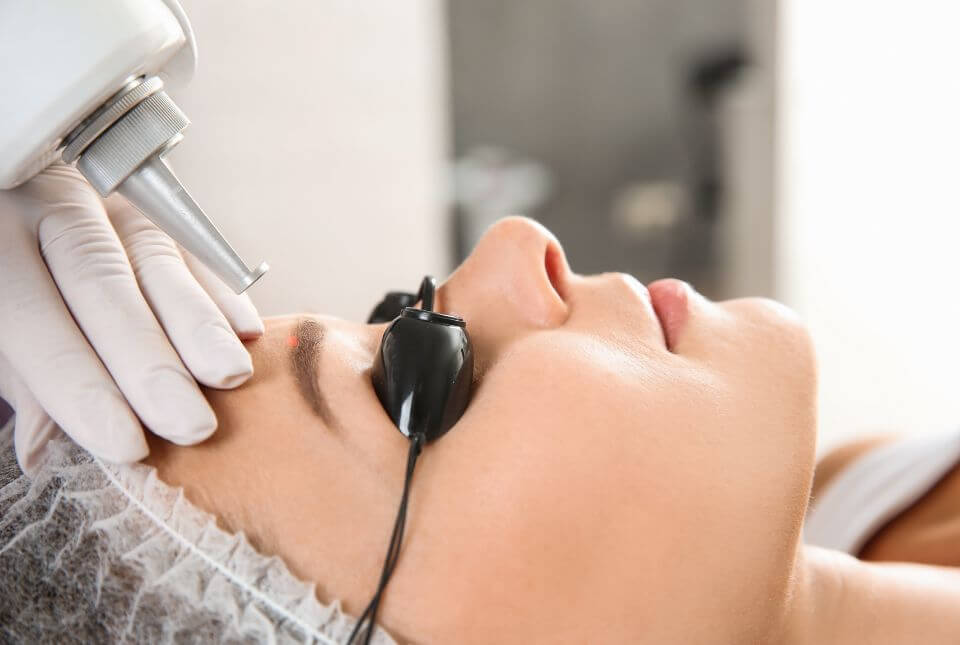 El poder del láser Descubre cómo eliminar la micro pigmentación y el microblading sin dolor ni
